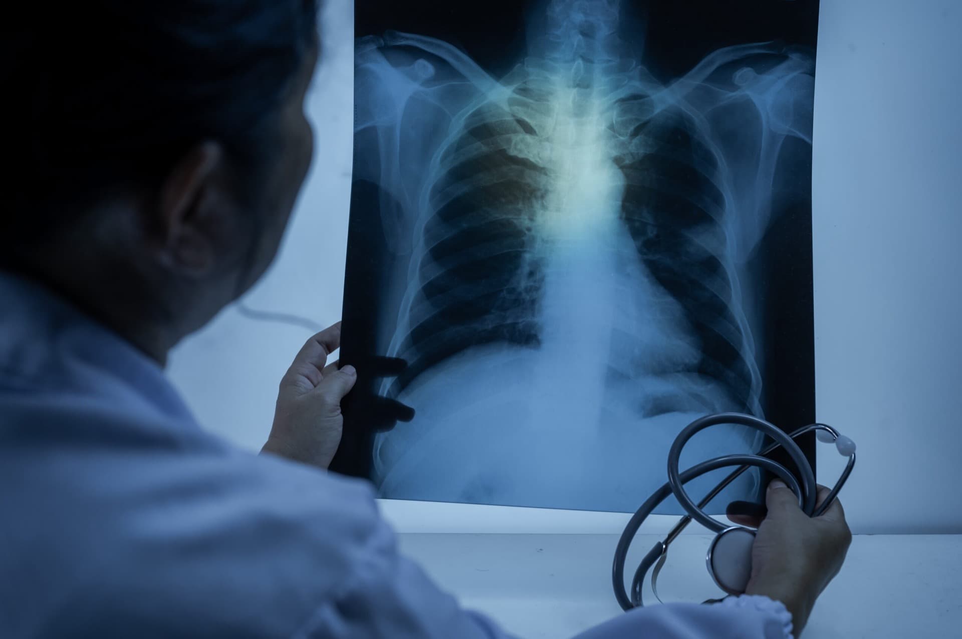 Medical Malpractice Attorney Oregon
